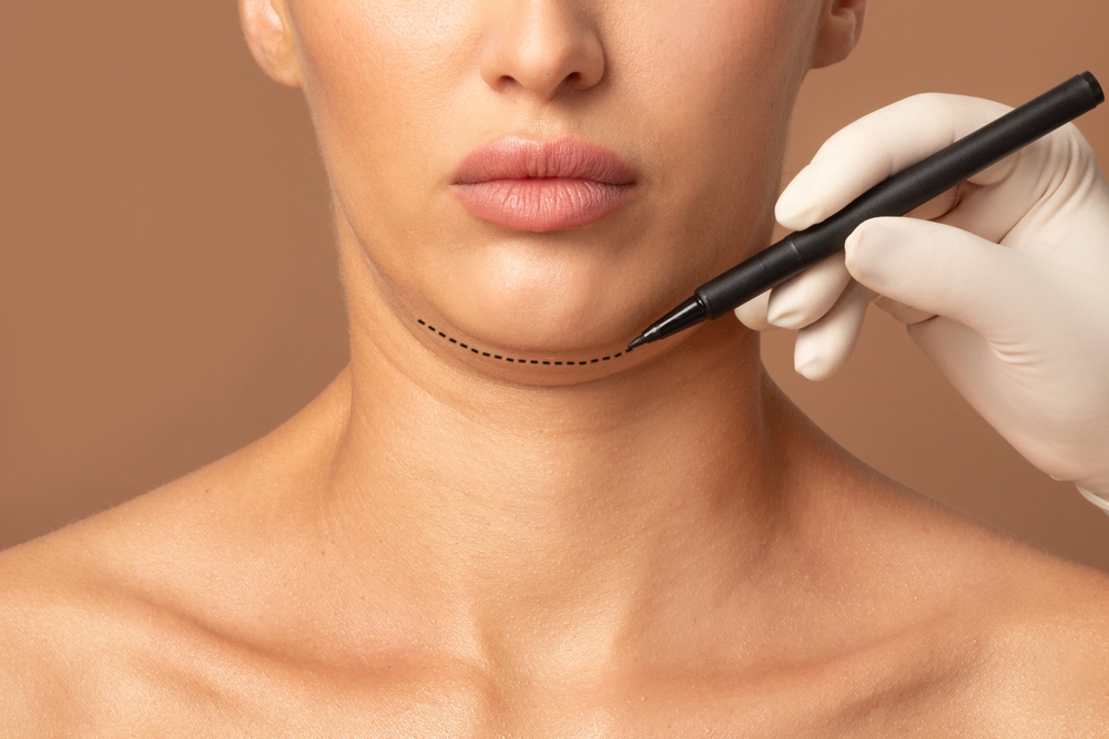 double chin treatment at novomed clinic