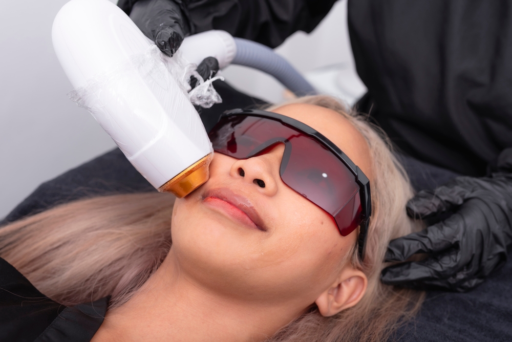 face laser hair removal in Dubai at novomed clinic