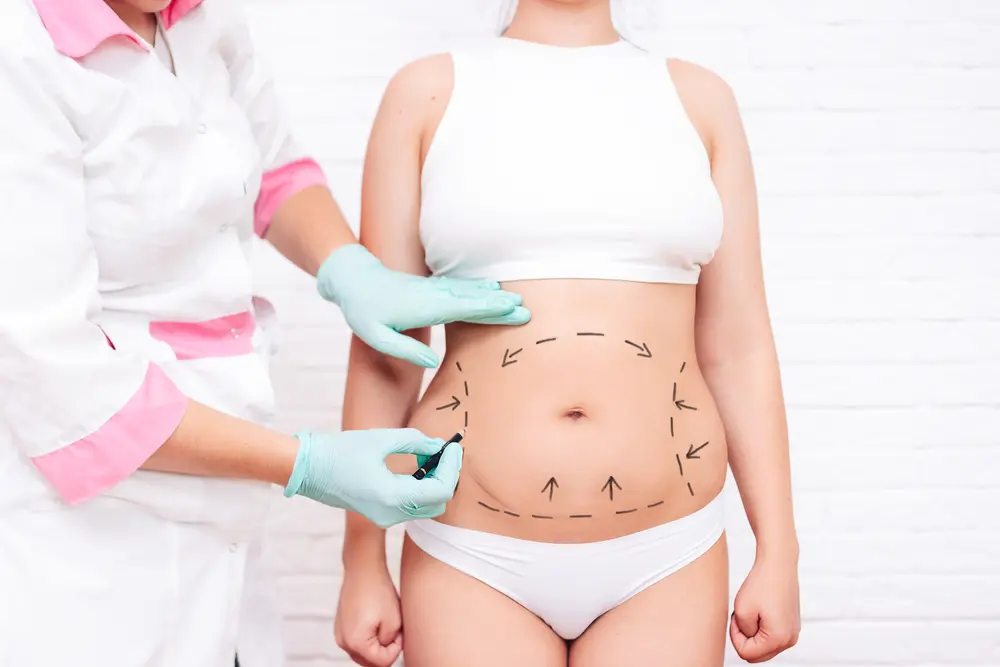 Tummy Tuck in Dubai | Abdominoplasty | Novomed
