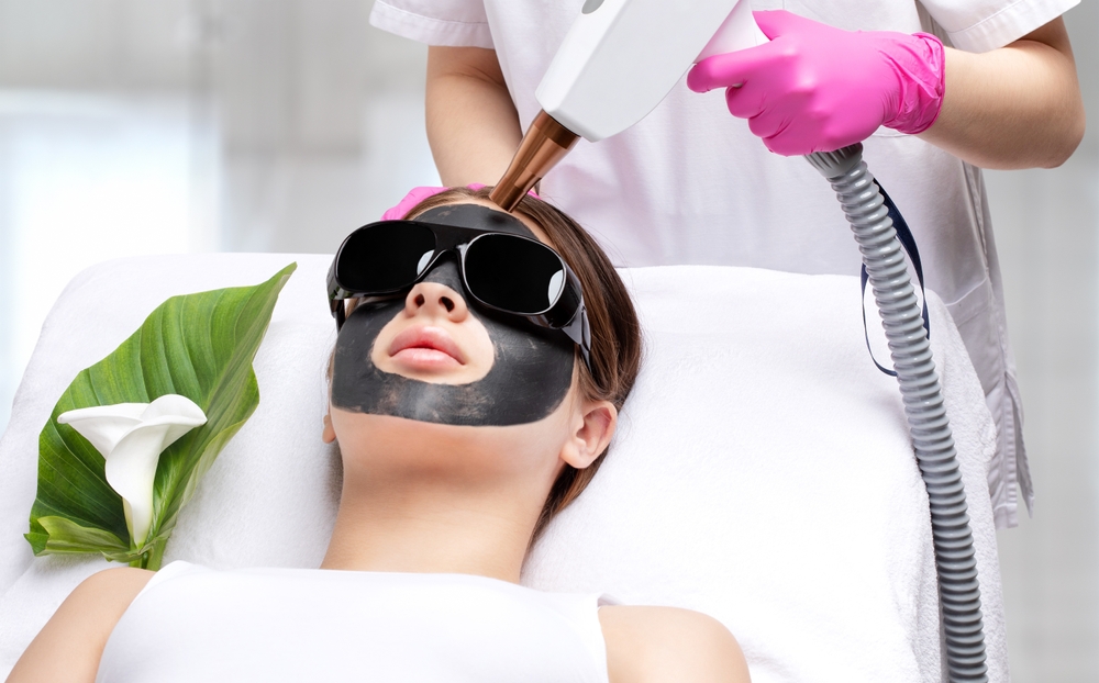 carbon laser facial at novomed clinic in Dubai