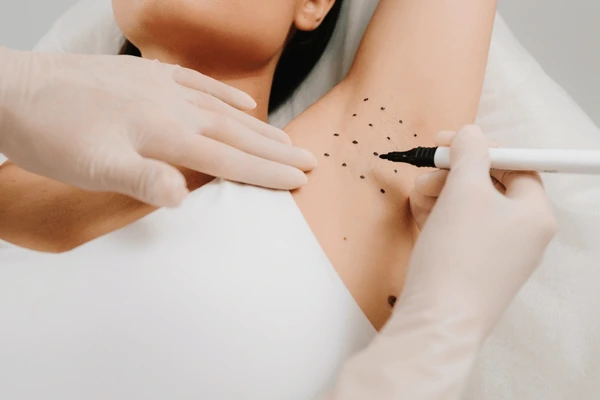 lady during Excessive Sweating treatment at novomed clinic in Dubai