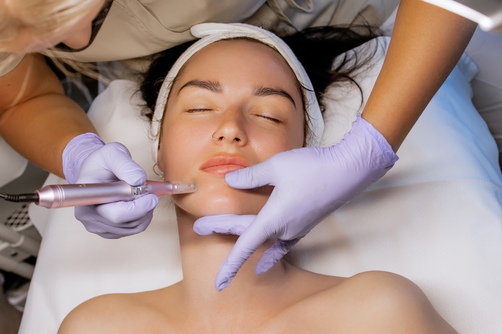 dermapen treatment dubai at novomed clinic