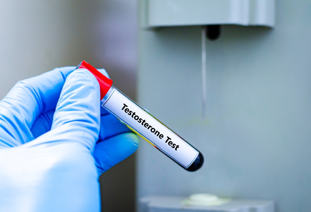 testosterone test at novomed clinic in dubai