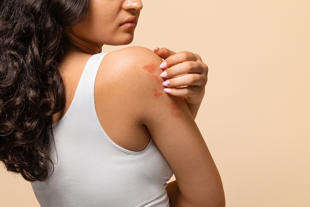 skin rash treatment at novomed clinic