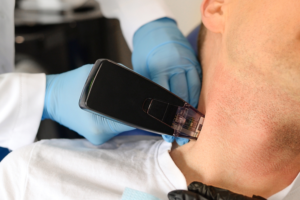 morpheus8 treatment in Dubai novomed clinic