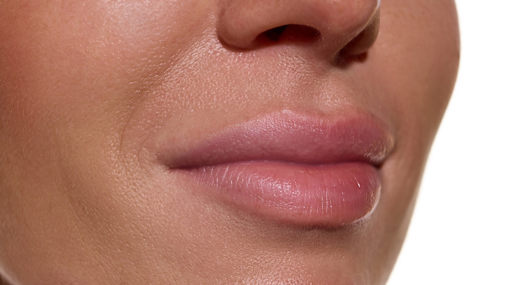 Laser Lip Lightening at novovmed clinic dubai