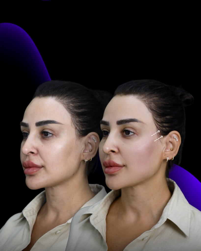 شد الجسم في دبي عيادة نوفومد