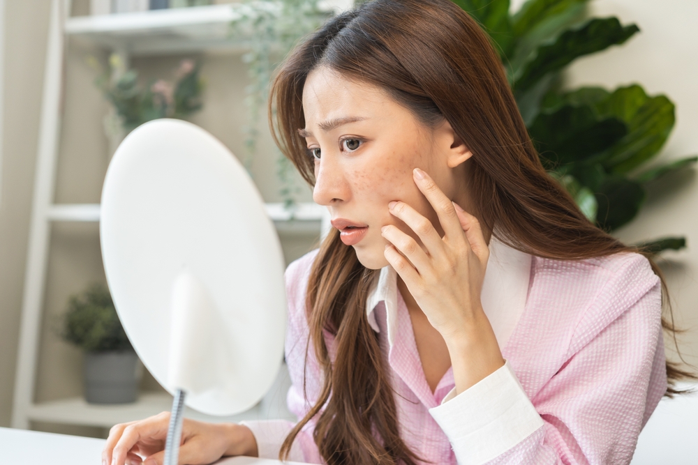 melasma treatment near me a novomed clinic in riyadh