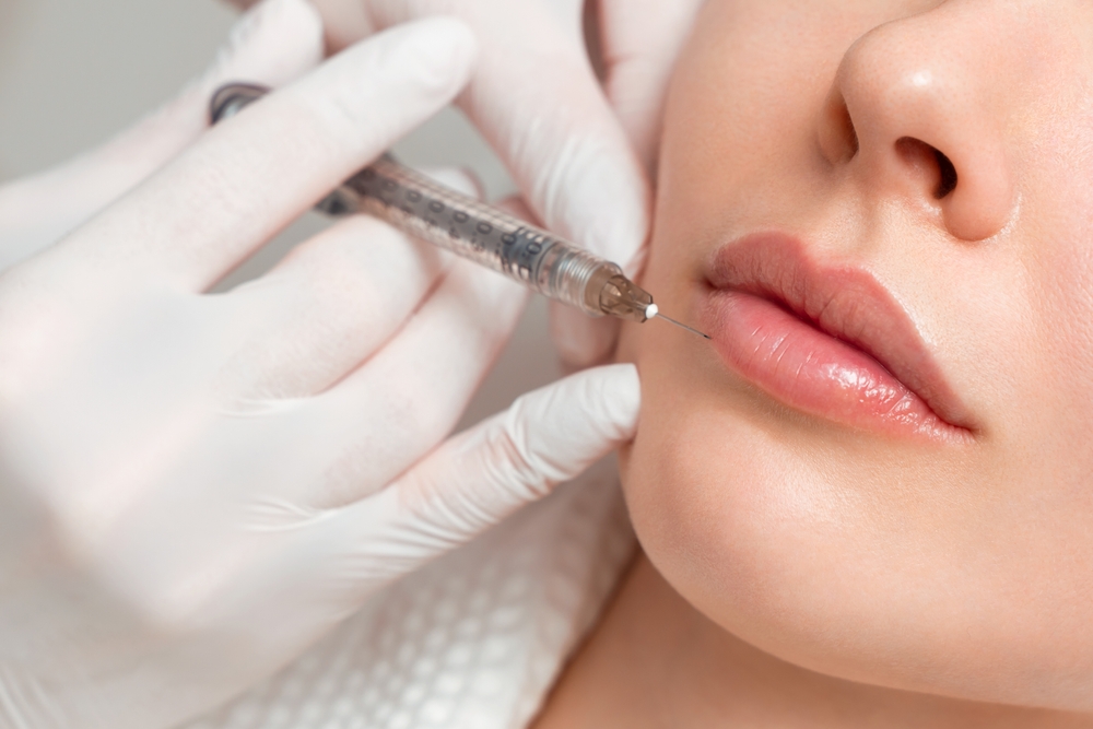 lip fillers abu Dhabi at novomed clinics