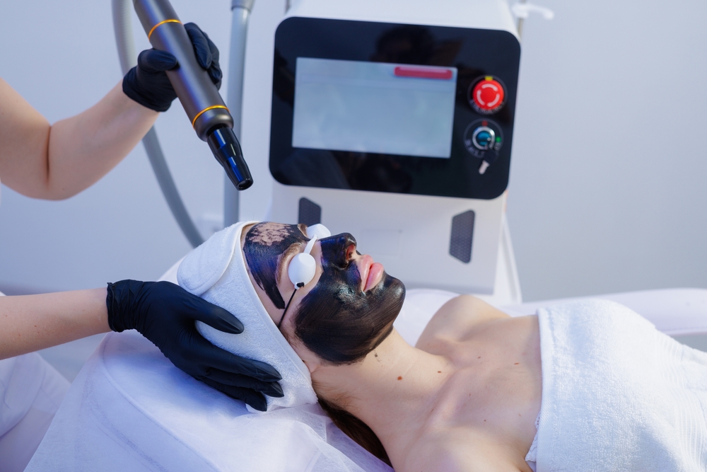 laser carbon peel near me in riyadh at novomed clinic