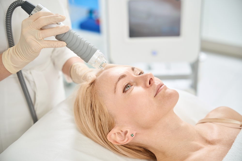 rf microneedling at novomed in Dubai