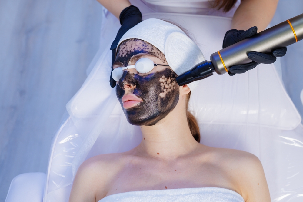 laser carbon peel in riyadh novomed clinic