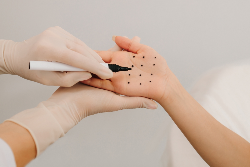Excessive Sweating riyadh novomed clinics
