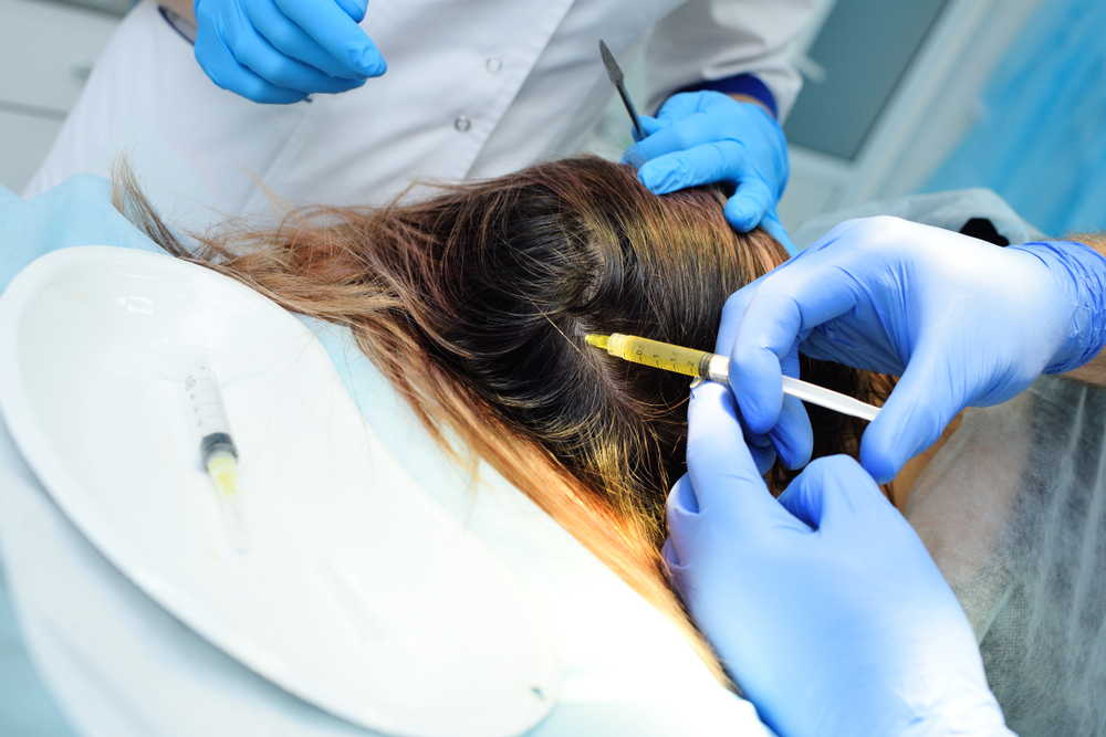 prp hair treatment riyadh at novomed clinic