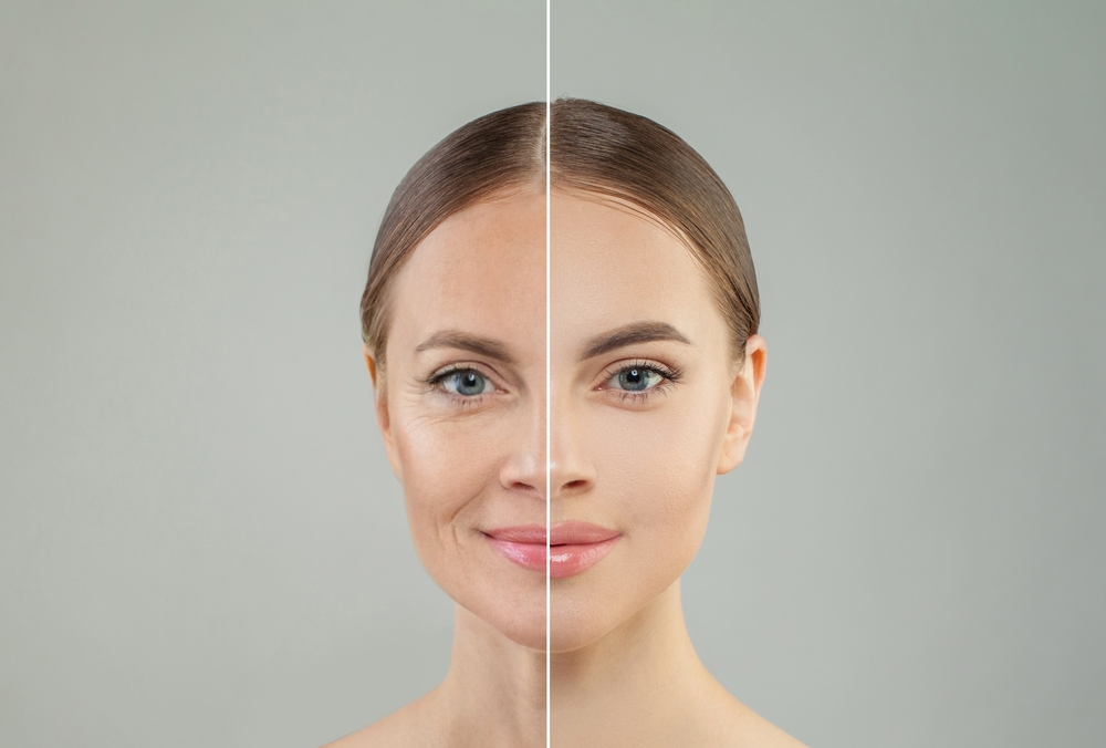 anti aging treatment at novomed clinic in Duabi